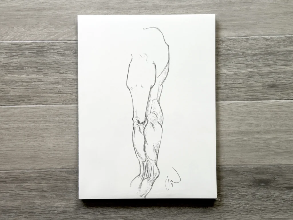 Arm-1